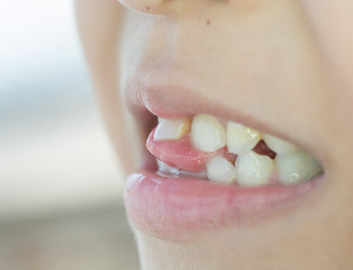 What to do about that pesky loose tooth!